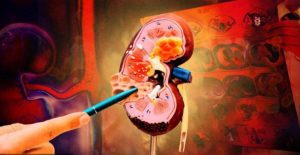 1b8c7fa5ade2965e7accc3cd0f86f4a5