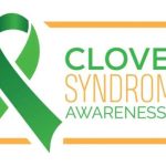 Cloves syndrome