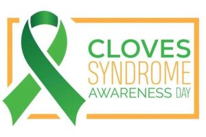Cloves syndrome