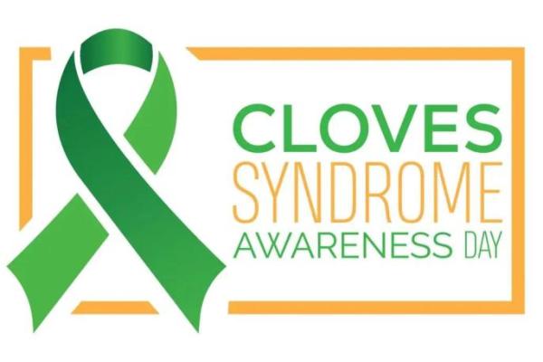 Tanggal 3 Agustus Diperingati Sebagai Hari Peduli Sindrom CLOVES 20 Cloves syndrome